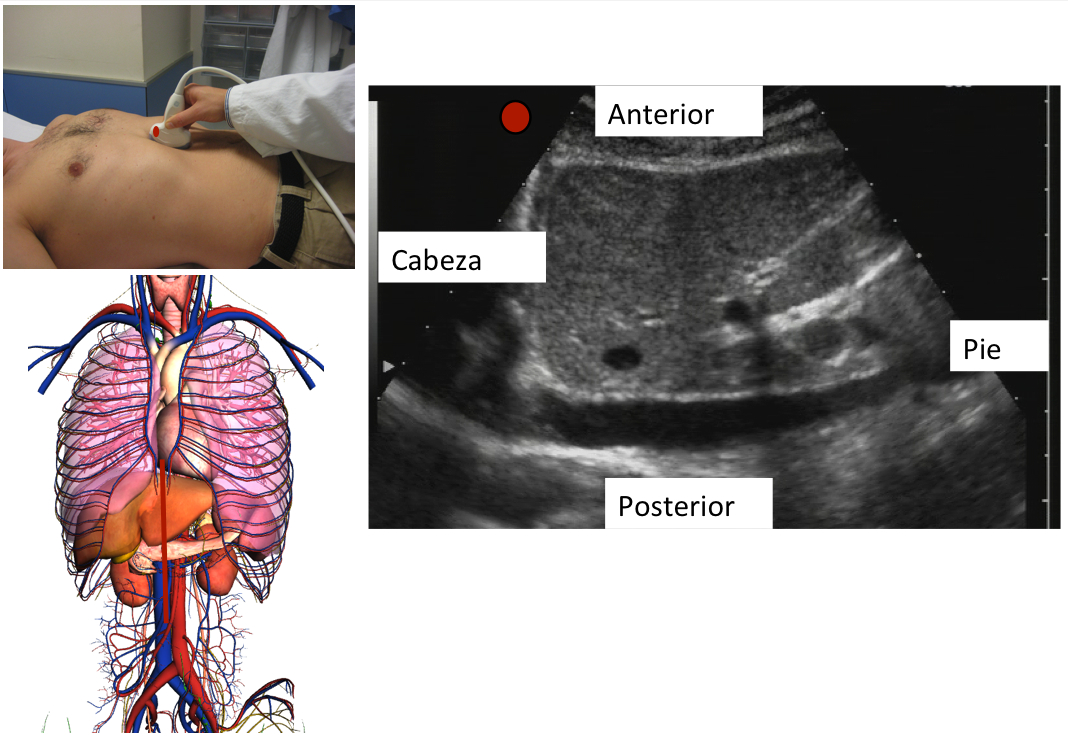 Plano Longitudinal O Sagital En Región Medial Y Superior Del Abdomen